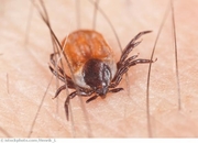 Was_ist_Borreliose