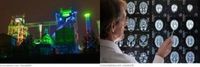 Duisburg Neurologie Duisburg Neurologie