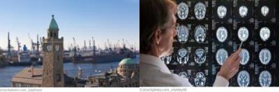 Hamburg Neurologie Hamburg Neurologie
