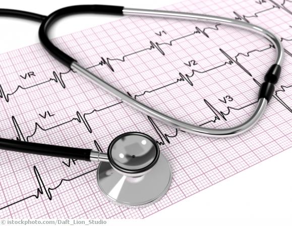 Angina pectoris Angina pectoris