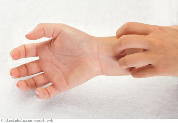 Dermatitis Dermatitis