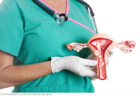 Endometriose Endometriose