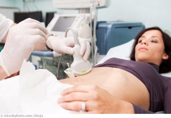 Hepatitis C Hepatitis C
