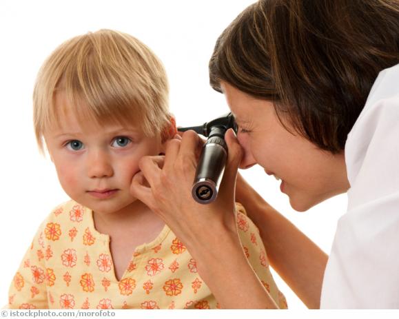 Mastoiditis Mastoiditis