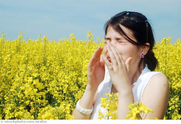 Sinusitis Sinusitis