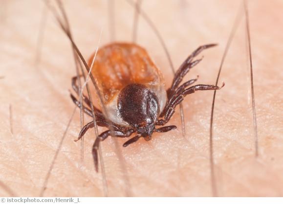 Was_ist_Borreliose Was_ist_Borreliose