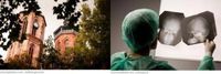 Göttingen Neurochirurgie