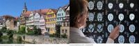Tübingen Neurologie Tübingen Neurologie