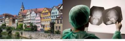 Tübingen Neurochirurgie Tübingen Neurochirurgie