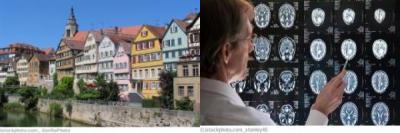Tübingen Neurologie Tübingen Neurologie